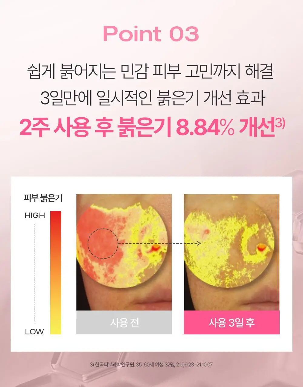 [NEW] 피지오겔 레드 수딩 AI 리페어 크림 100ml 상세페이지 15